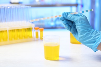 Laboratory assistant doing analysis with urine sample and litmus paper on table, closeup