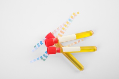 Test tubes with urine samples for analysis on white background, top view