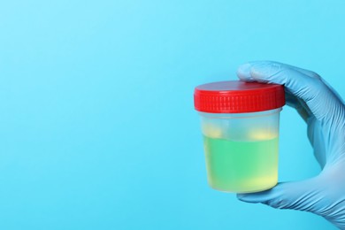 Doctor wearing glove holding container with urine sample for analysis on light blue background, closeup. Space for text