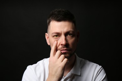 Man checking his health condition on black background. Yellow eyes as symptom of problems with liver