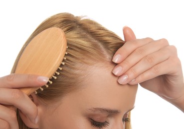 Photo of Woman with hair loss problem on white background, closeup. Trichology treatment