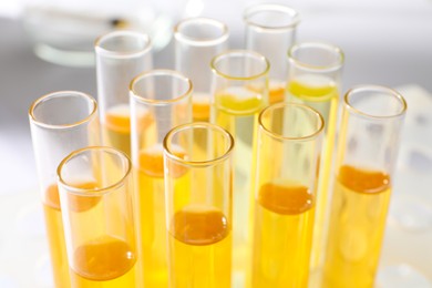 Tubes with urine samples for analysis on blurred background, closeup