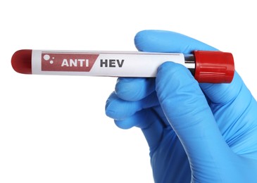 Scientist holding tube with blood sample and label Anti HEV on white background, closeup