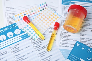Laboratory ware with urine samples for analysis on test form, above view
