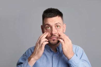 Man checking his health condition on grey background. Yellow eyes as symptom of problems with liver