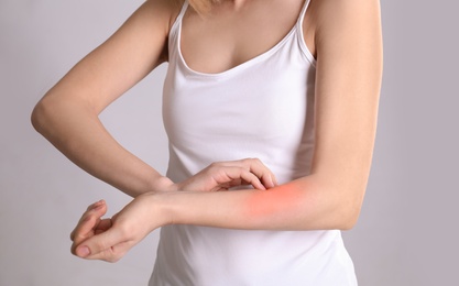 Woman with allergy symptoms scratching forearm on grey background, closeup