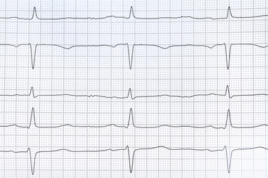 Photo of Cardiogram report as background, top view. Heart diagnosis