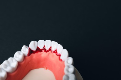 Photo of Jaw model with blood on black background, above view and space for text. Gum inflammation