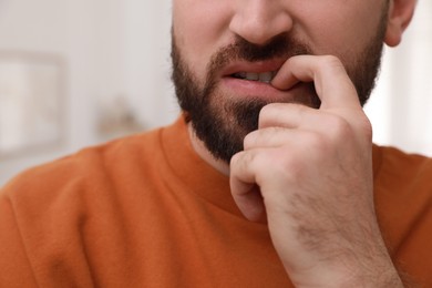 Man biting his nails on blurred background, closeup. Bad habit