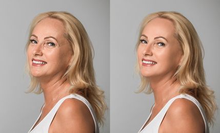 Image of Mature woman before and after cosmetic procedure on grey background 