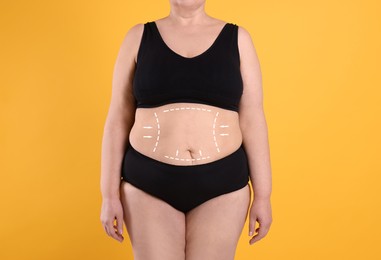 Woman with marks on body before cosmetic surgery operation on orange background, closeup