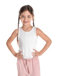 Little girl with chickenpox on white background