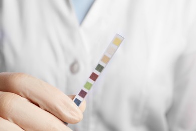 Doctor holding urine test strips, closeup view