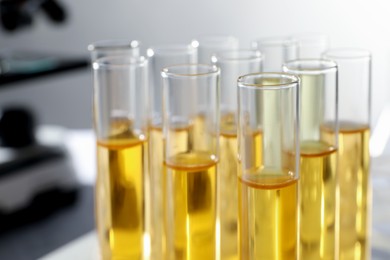 Tubes with urine samples for analysis in laboratory, closeup