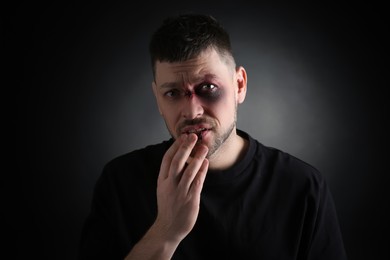 Man with facial injuries on dark background. Domestic violence victim