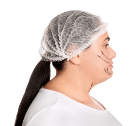 Woman with double chin ready for cosmetic surgery operation on white background