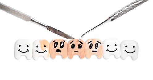 Decorative healthy and damaged teeth with dentist tools on white background, top view