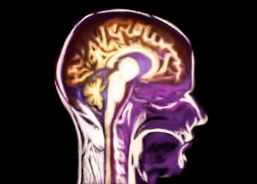 Scan of human brain area on black background, illustration