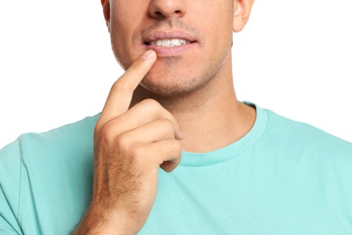 Photo of Man with herpes touching lips against white background, closeup