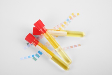 Test tubes with urine samples for analysis on white background, top view