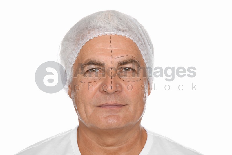 Portrait of senior man with marks on face preparing for cosmetic surgery against white background