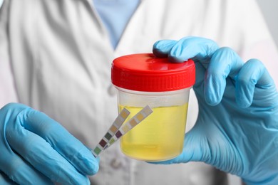 Photo of Doctor holding container with urine sample and test strips for analysis, closeup