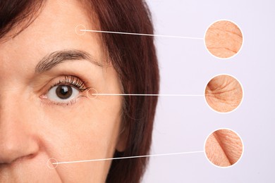 Image of Beautiful mature woman on light background, closeup. Zoomed skin areas showing wrinkles before rejuvenation procedures