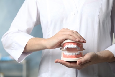 Dentist holding educational model of oral cavity with teeth in clinic, closeup