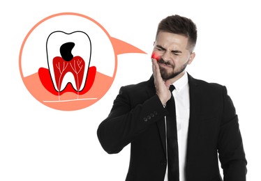 Man suffering from acute toothache on white background