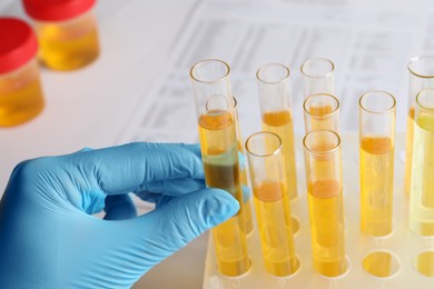 Photo of Nurse holding tube with urine sample for analysis at table, closeup