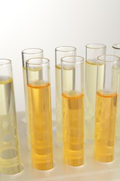 Tubes with urine samples for analysis on light grey background, closeup