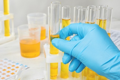 Laboratory worker taking test tube with urine sample from holder, closeup. Urology concept