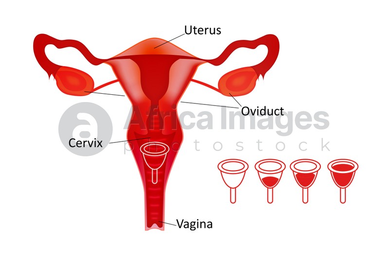 Instruction how to use menstrual cup during period. Female reproductive system on white background, illustration