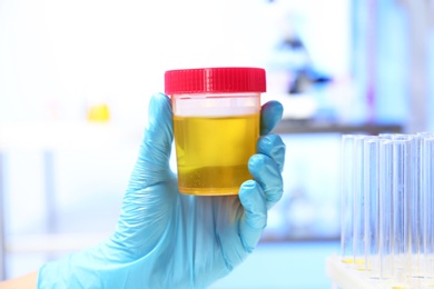 Laboratory assistant holding container with urine sample for analysis indoors, closeup