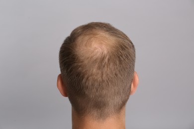 Man with hair loss problem on grey background, back view. Trichology treatment