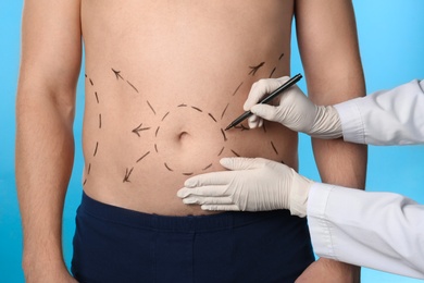 Doctor drawing marks on man's body for cosmetic surgery operation against blue background, closeup
