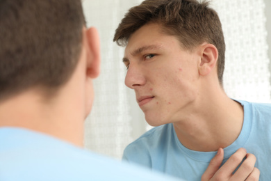 Teen guy with acne problem near mirror indoors
