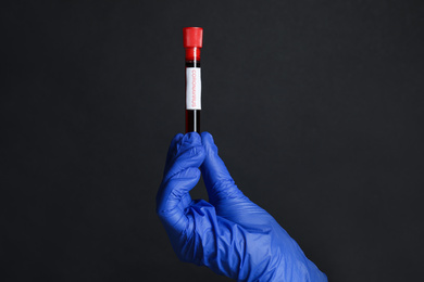 Scientist holding test tube with blood sample and label CORONA VIRUS on black background, closeup