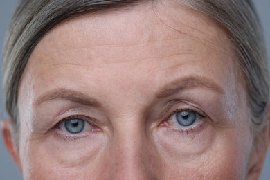 Photo of Senior woman with aging skin on grey background, closeup. Rejuvenation treatment