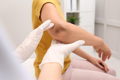 Doctor examining woman with bruise on elbow in clinic, closeup