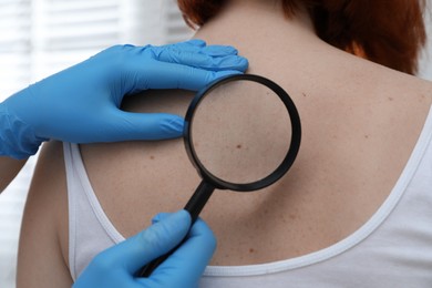 Dermatologist examining patient's birthmark with magnifying glass in clinic, closeup view