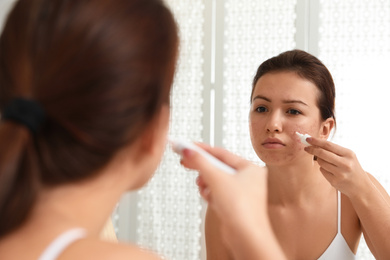 Photo of Teen girl with acne problem applying cream near mirror in bathroom