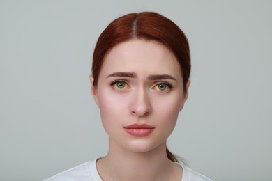 Upset woman with yellow eyes on light grey background. Symptom of hepatitis