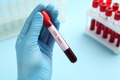 Scientist holding tube with blood sample and label STD Test on light blue background, closeup