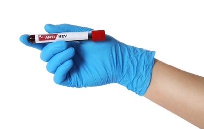 Scientist holding tube with blood sample and label Anti HEV on white background, closeup