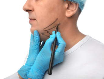 Surgeon with marker preparing man for operation on white background. Double chin removal