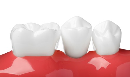 Educational model of gum with teeth on white background