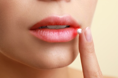 Young woman with cold sore applying cream onto lips against beige background, closeup