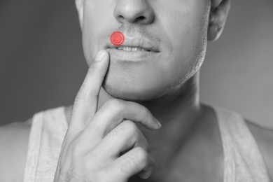 Man with herpes touching lips against grey background, closeup. Black and white effect