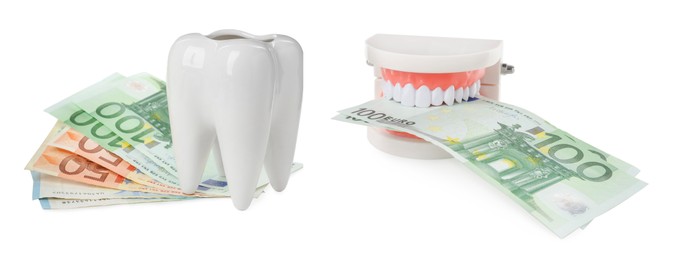 Collage with educational dental models and money on white background, banner design. Expensive teeth treatment